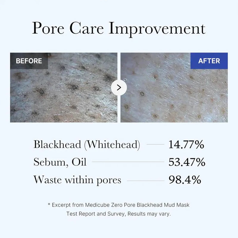 Medicube Zero Pore Blackhead Mud Mask - 100g - Free Applicator