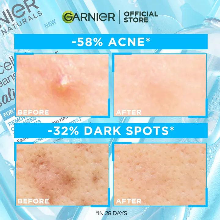 Garnier Bright Complete Anti-Acne Cleansing Foam - 100ml.